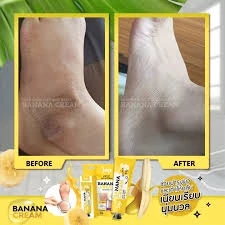 香蕉霜 50g 足部保湿霜 Joji Secret Young Soft Your Feet And Heels 2