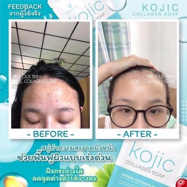 Kojic曲酸胶原蛋白皂 60g 极致美白皂 彻底清除毛孔杂质 2