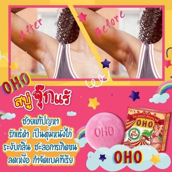 OHO腋下美白皂 80g 特效清洁深色鸡皮疹 男女通用沐浴皂 1